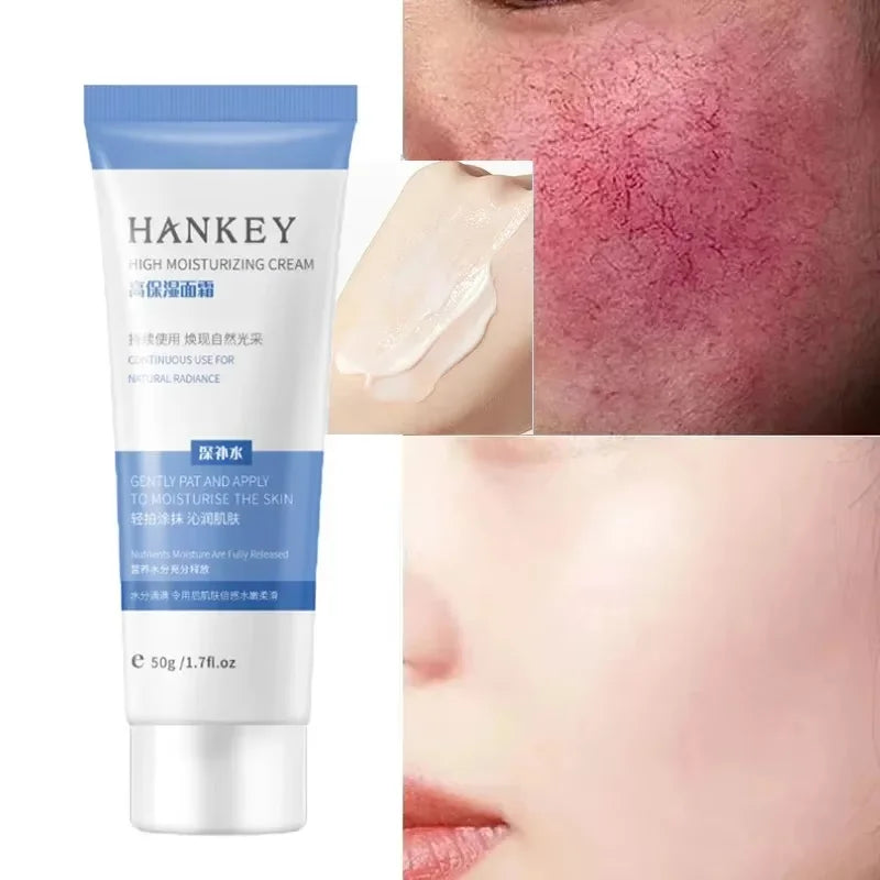 Facial Redness Repair Cream