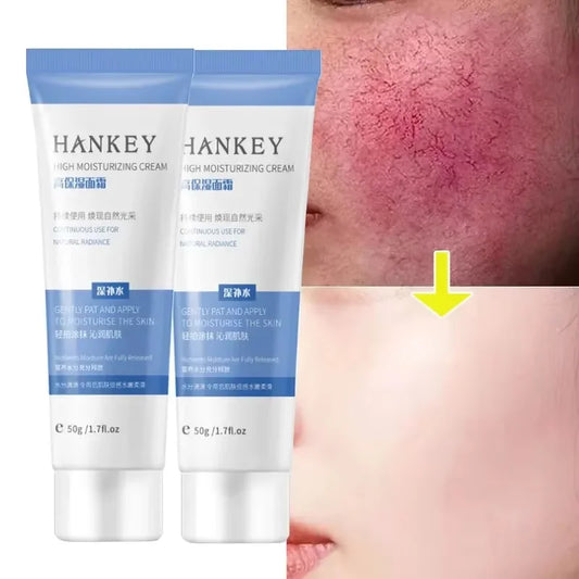 Facial Redness Repair Cream
