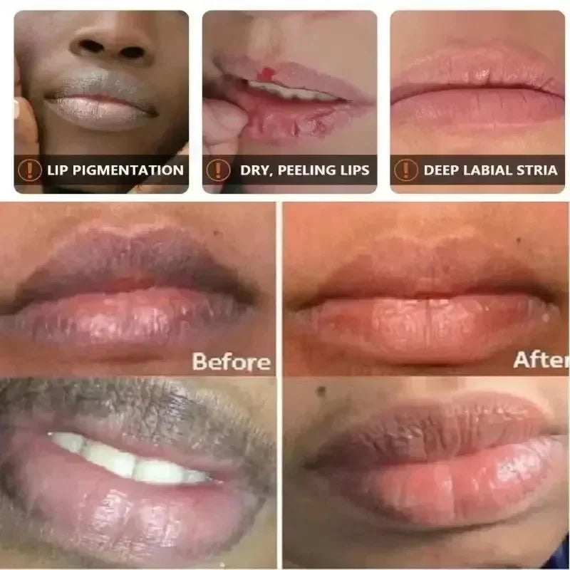 Dark Lip Melanin Correcting Balm