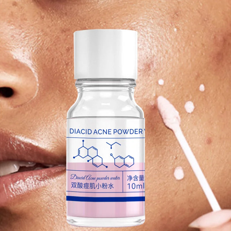 10ml Salicylic Acid Acne Essence