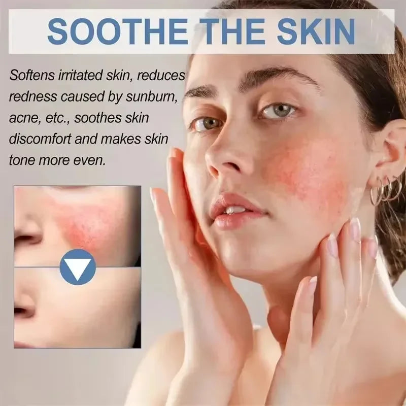 Facial Redness Repair Cream