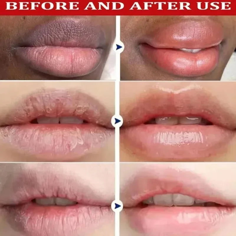 Dark Lip Melanin Correcting Balm